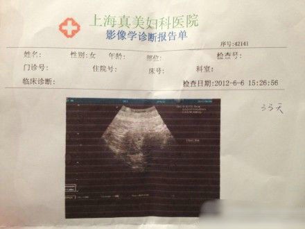 袁莉老公曝妻懷孕一月,曬其B超照。