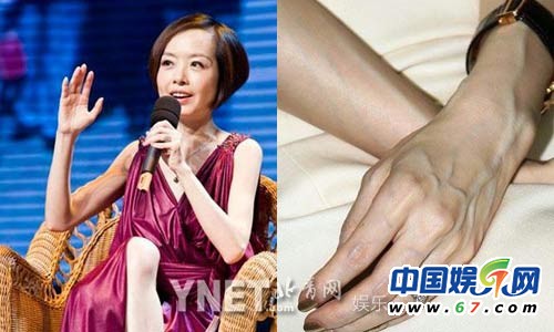 女星排骨盡顯嚇死網友